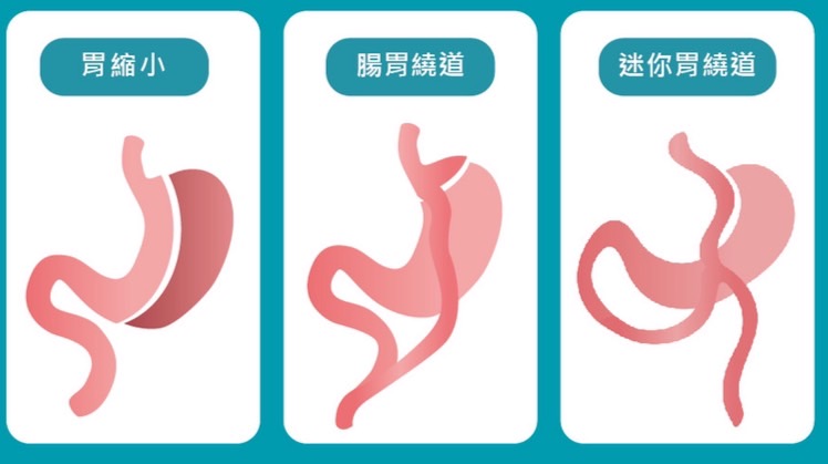 胃模型設計-義大醫療財團法人